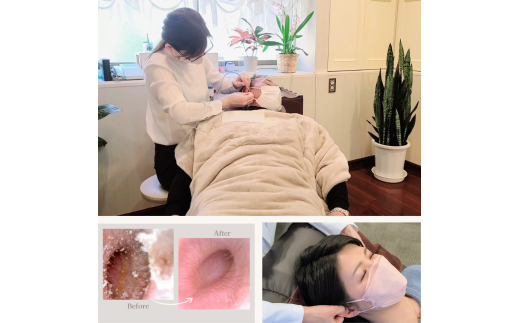 022-016 【プロ耳掃除】イヤーエステ体験