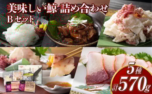 【7営業日以内発送】美味しい鯨5種詰め合わせBセット (大和煮缶詰・オバ鯨・ベーコンスライス・湯かけくじら・さえずりスライス) 合計570g ／ 鯨 クジラ肉 鯨料理 セット 珍味
